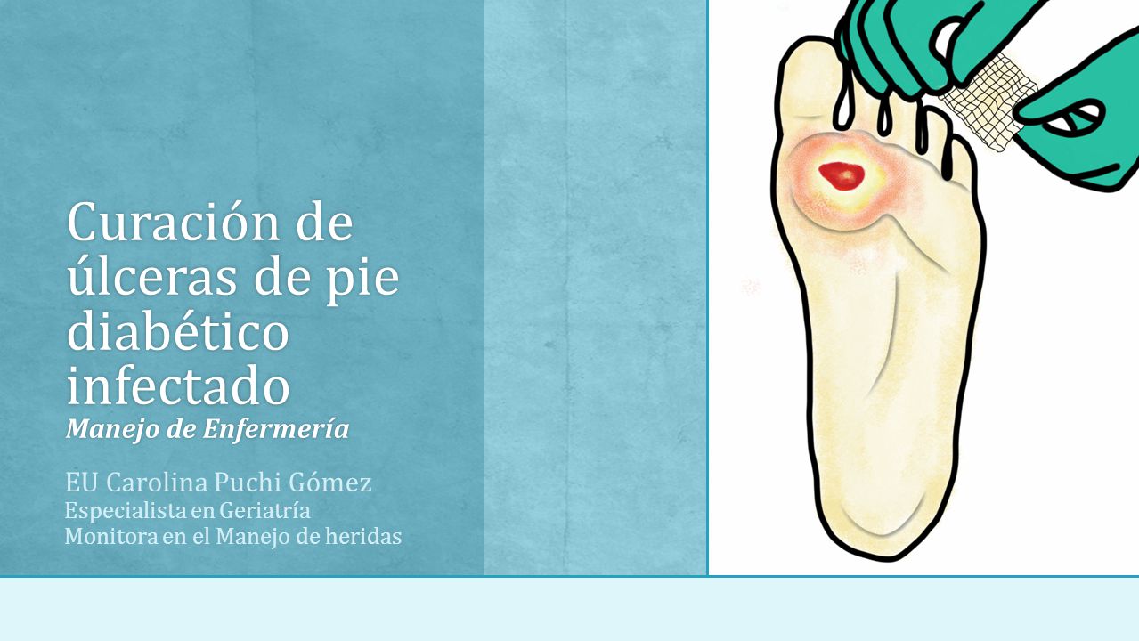 CURACION HERIDAS ENFERMERIA EBOOK DOWNLOAD CURACION HERIDAS ENFERMERIA EBOOK DOWNLOAD